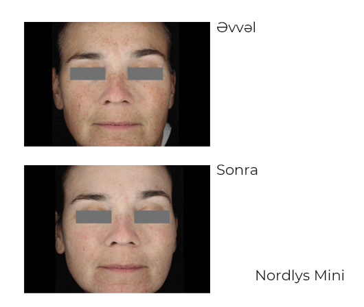 684c03cad148f_nordlys-mini-2 (1).png